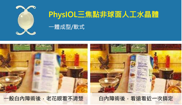 PhysIOL三焦點非球面人工水晶體(一體成形/軟式)